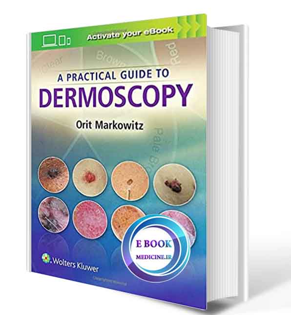 دانلود کتاب A Practical Guide to Dermoscopy2017( PDF)